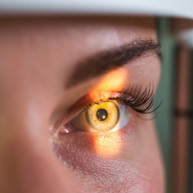 Vision Therapy in Lemont